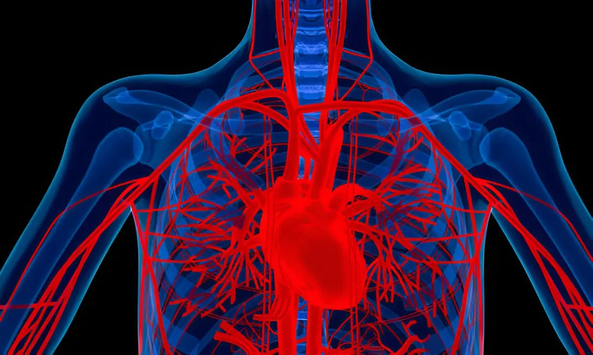 Aortos disekcija