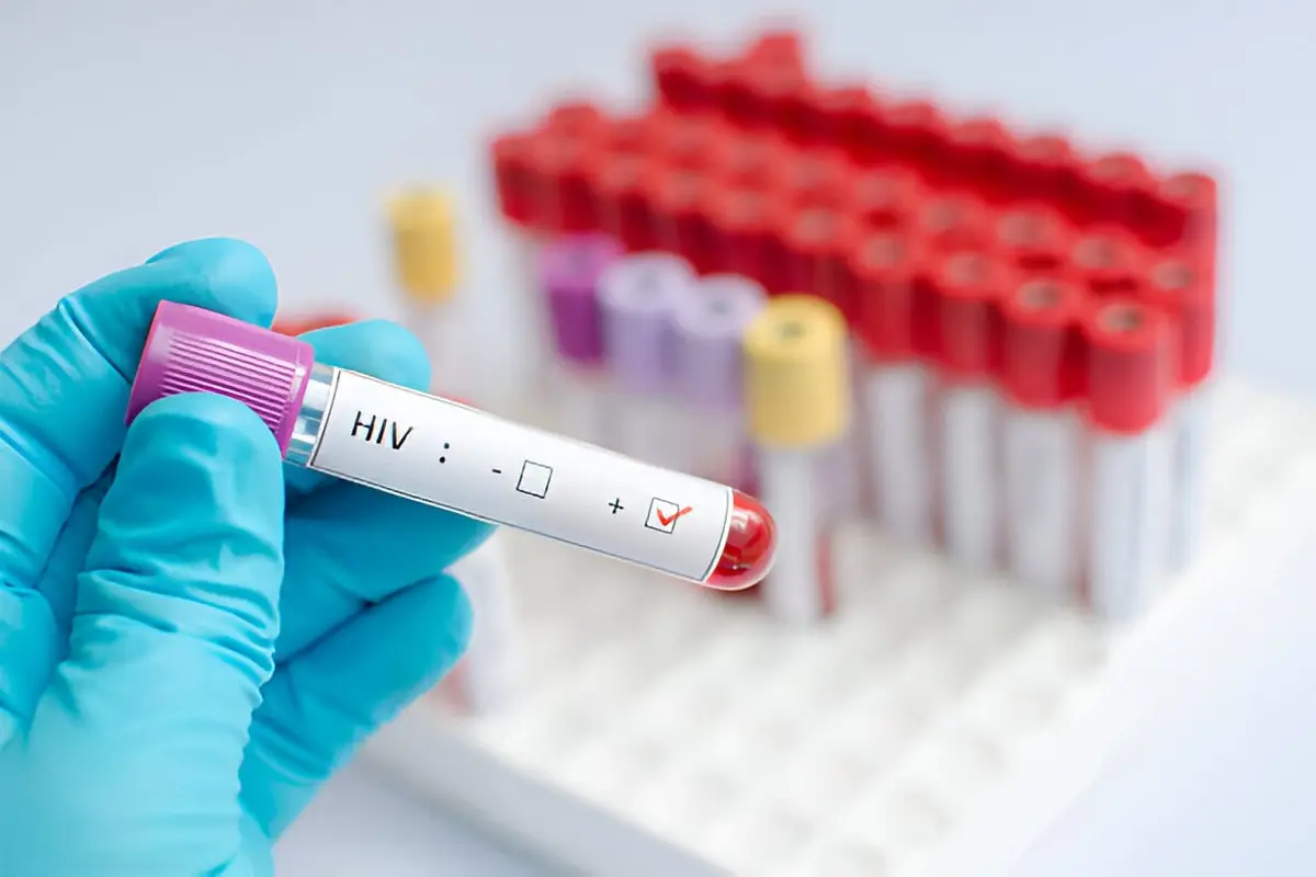 ŽIV ir AIDS