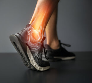 Kulkšnies skausmas po vaikščiojimo