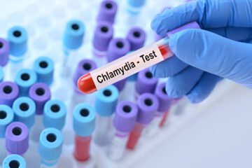 Chlamidija
