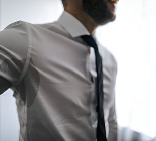 Per didelis prakaitavimas