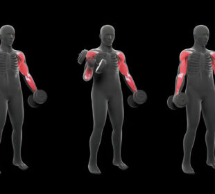 Raumenų tonuso sutrikimai