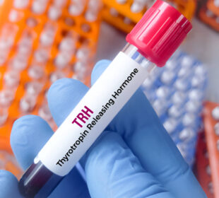tirotropinas