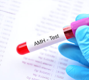 Sužinokite, ką reiškia AMH (anti-mullerian hormone) tyrimas, kaip jis atliekamas ir ką gali rodyti jūsų AMH lygiai apie reprodukcinę sveikatą