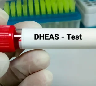 DHEAS kraujo tyrimas