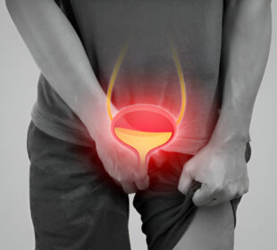 Dažnas šlapinimasis