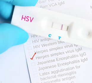 Herpeso testas