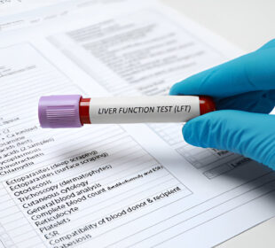 Kepenų funkcijos testas