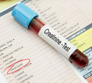Serumo kreatinino tyrimas