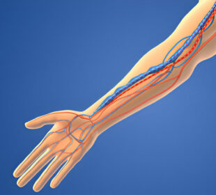 Arterioveninė jungtis